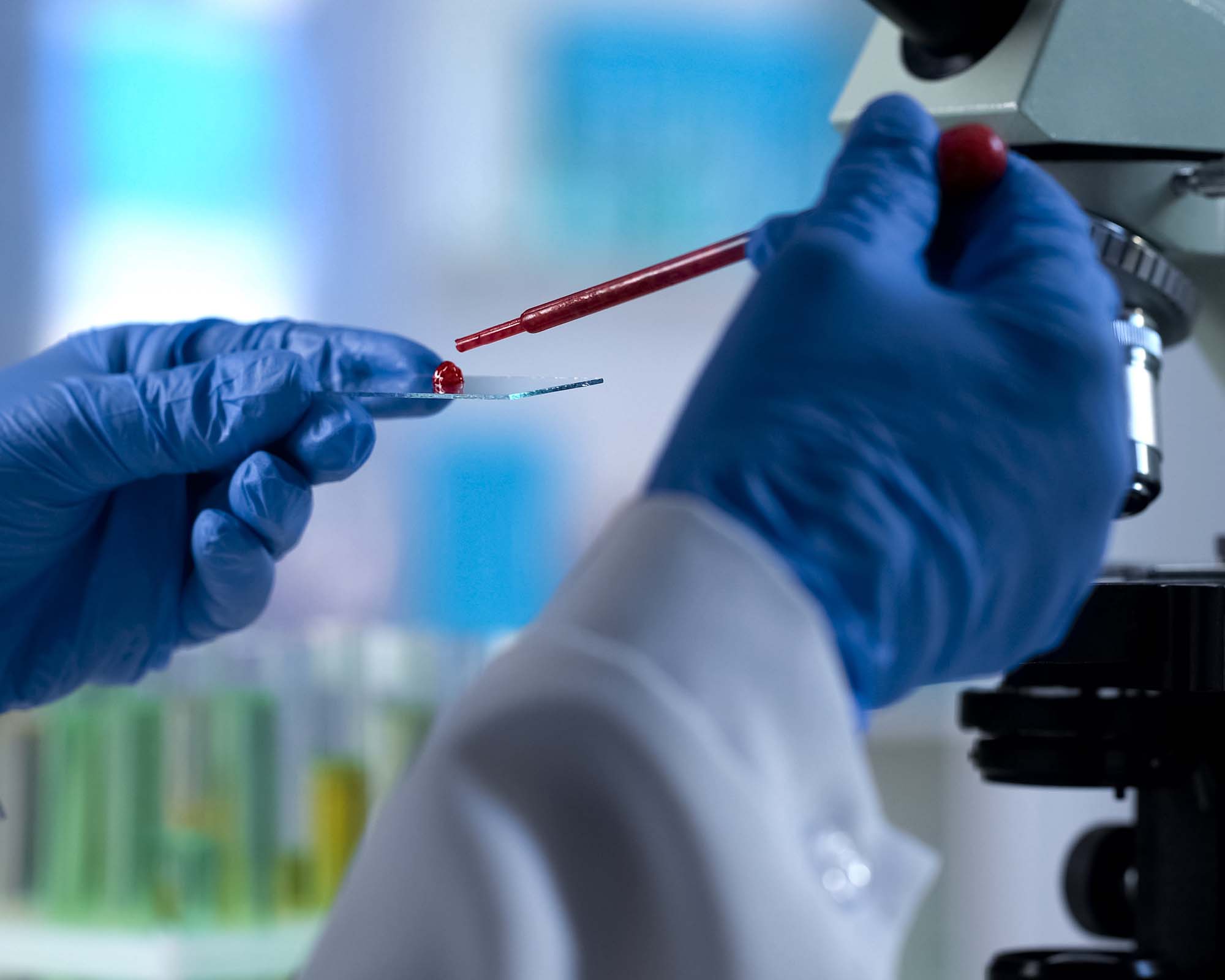 a-top-medical-device-company-improved-specimen-tracking-to-prevent-errors-in-diagnosis-and-treatment-solution-image.jpg