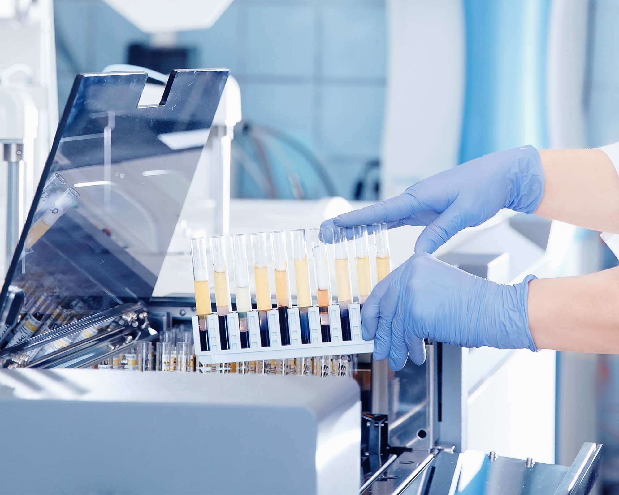 a-top-medical-device-company-improved-specimen-tracking-to-prevent-errors-in-diagnosis-and-treatment-hero-banner.jpg