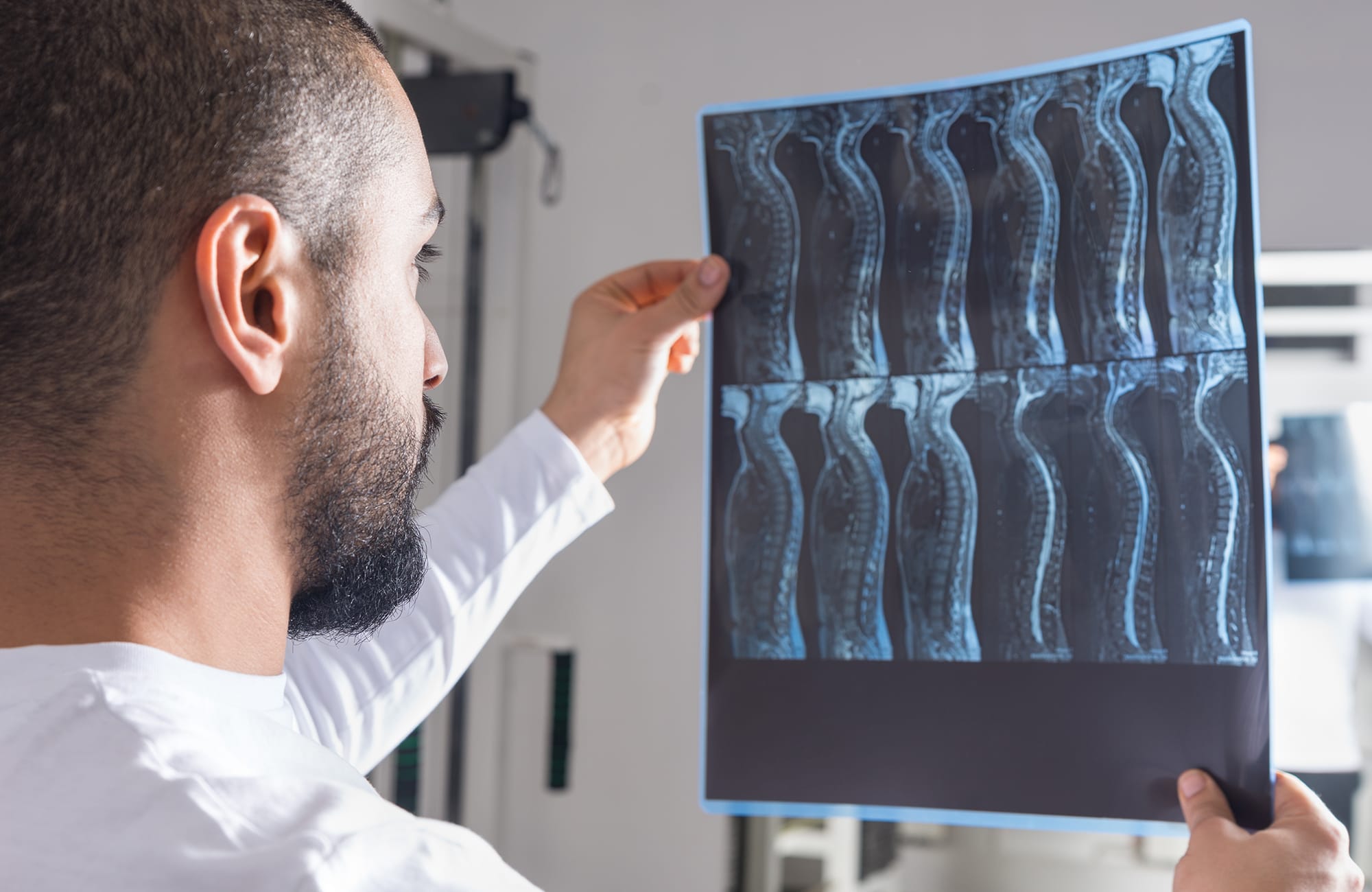 spinal_cord_stimulators_for_chronic-1.jpg